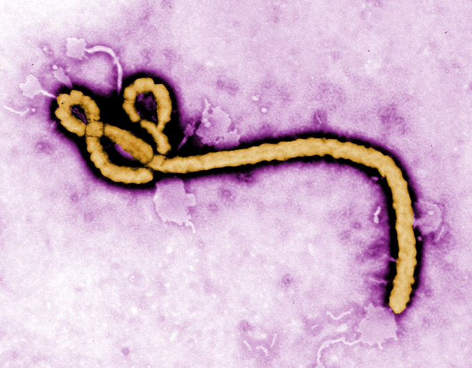 http://ebuenasnoticias.com/wp-content/uploads/2014/09/ebola.jpg
