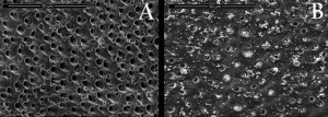 Imagen de microscopio electrónico de barrido (MEB), en la que se observa la dentina expuesta tras el ataque del ácido cítrico, en situación de máxima hipersensibilidad (Parte A); y la dentina después del tratamiento con fitoesfingosina.