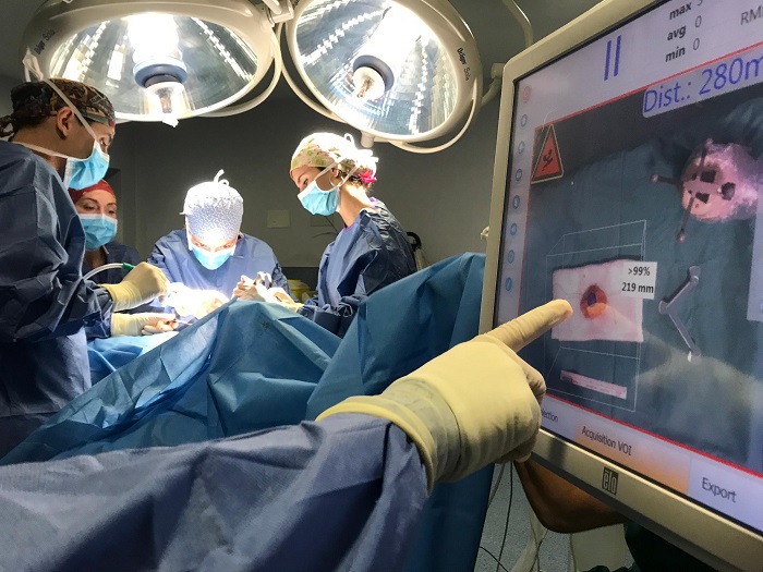 El Peset aplica una técnica innovadora de cirugía radioguiada para cáncer
