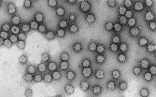Virus de la familia Coronaviridae./ LUIS ENJUANES/ CSIC-CNB