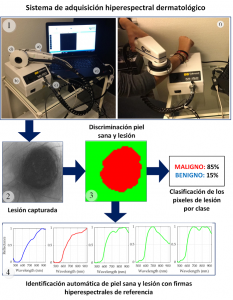 Crean una instrumentación capaz de diagnosticar el cáncer de piel