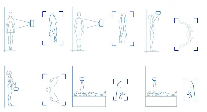 Diseñan el primer protocolo fotográfico para planificar cirugías de cáncer de mama Diseñan el primer protocolo fotográfico para planificar cirugías de cáncer de mama