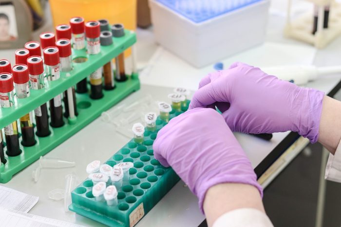 Madrid amplía a otras siete zonas la realización de test de antígenos