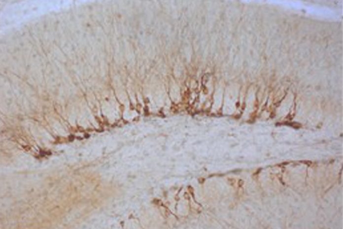 Científicos españoles consiguen rejuvenecer zonas del cerebro en ratones
